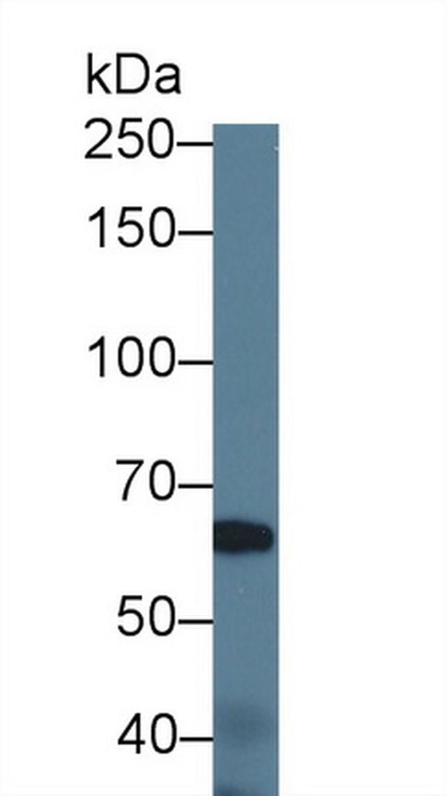 ABCA3 Antibody in Western Blot (WB)