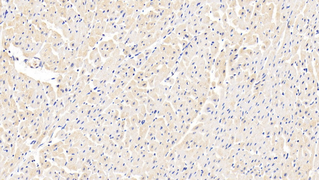 ABCB8 Antibody in Immunohistochemistry (Paraffin) (IHC (P))