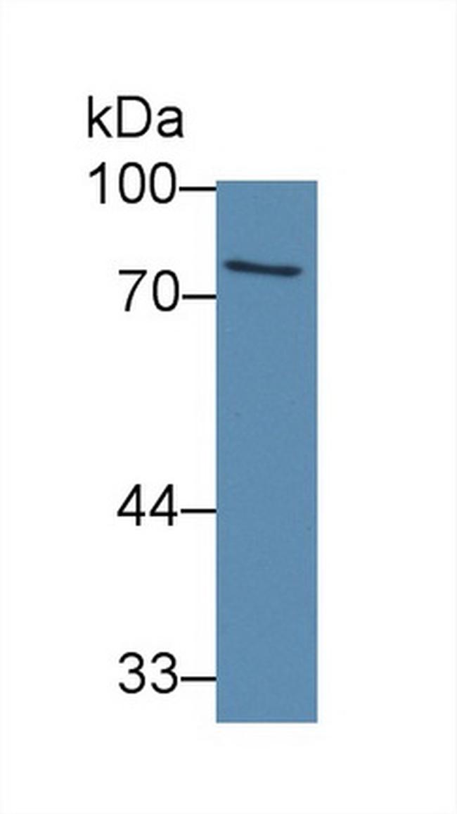 ABCB8 Antibody in Western Blot (WB)