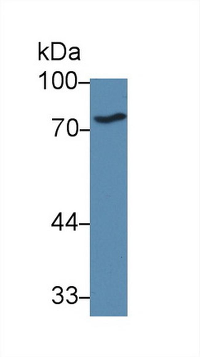 ABCB8 Antibody in Western Blot (WB)