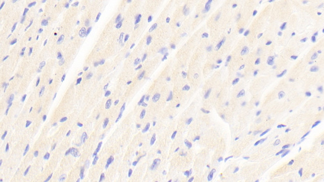 ABCD2 Antibody in Immunohistochemistry (Paraffin) (IHC (P))