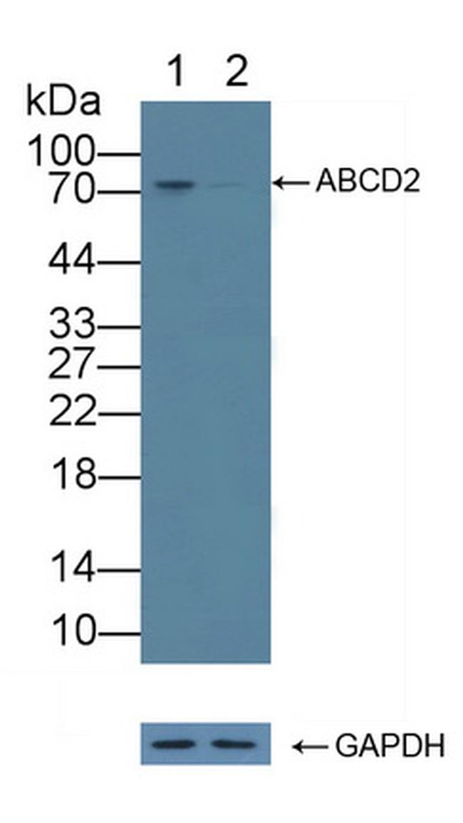 ABCD2 Antibody in Western Blot (WB)