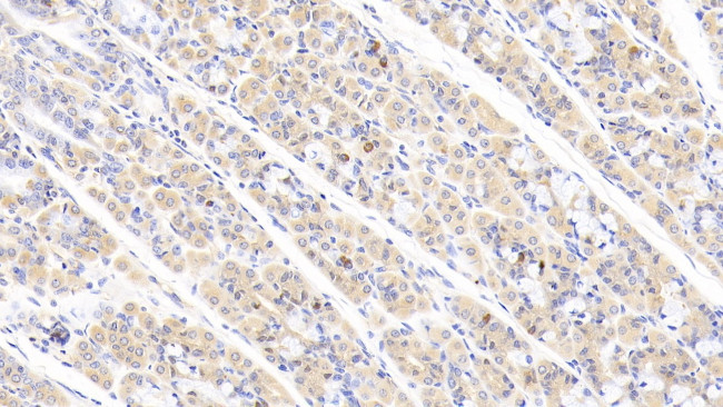 ABCF1 Antibody in Immunohistochemistry (Paraffin) (IHC (P))