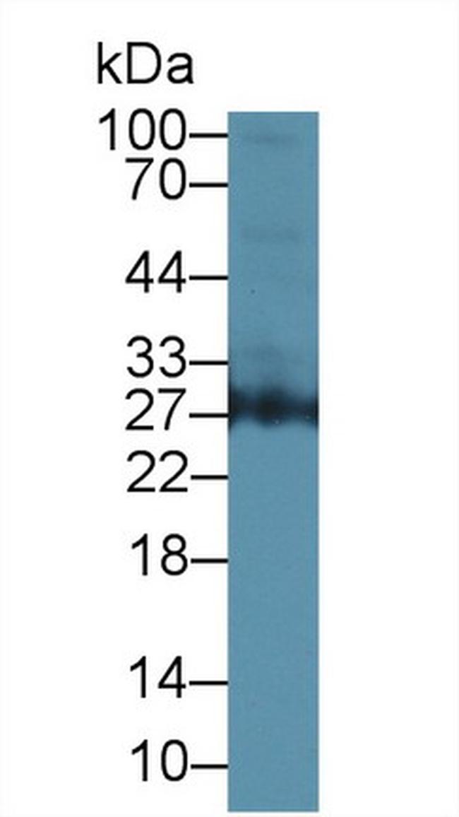 Azurocidin Antibody in Western Blot (WB)