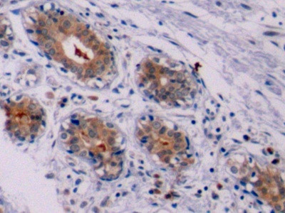 Bcl-2 Antibody in Immunohistochemistry (Paraffin) (IHC (P))