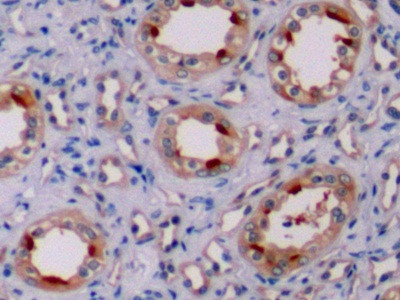 Bcl-2 Antibody in Immunohistochemistry (Paraffin) (IHC (P))