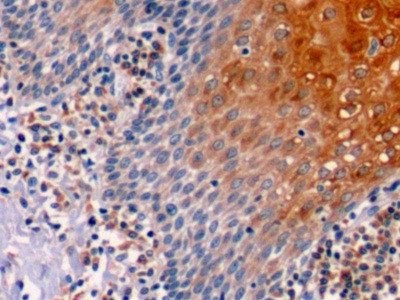 Bcl-2 Antibody in Immunohistochemistry (Paraffin) (IHC (P))