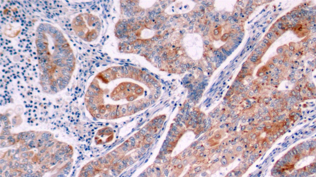 Bcl-2 Antibody in Immunohistochemistry (Paraffin) (IHC (P))