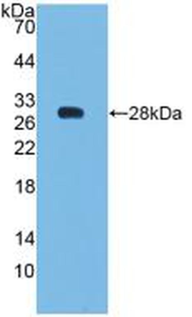 Bcl-2 Antibody in Western Blot (WB)