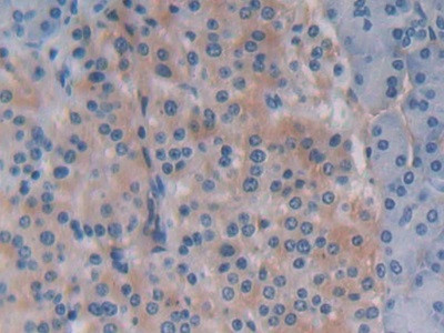 Beclin 1 Antibody in Immunohistochemistry (Paraffin) (IHC (P))