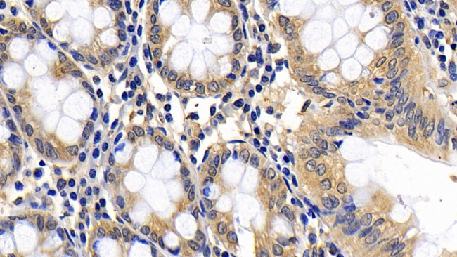 BID Antibody in Immunohistochemistry (Paraffin) (IHC (P))