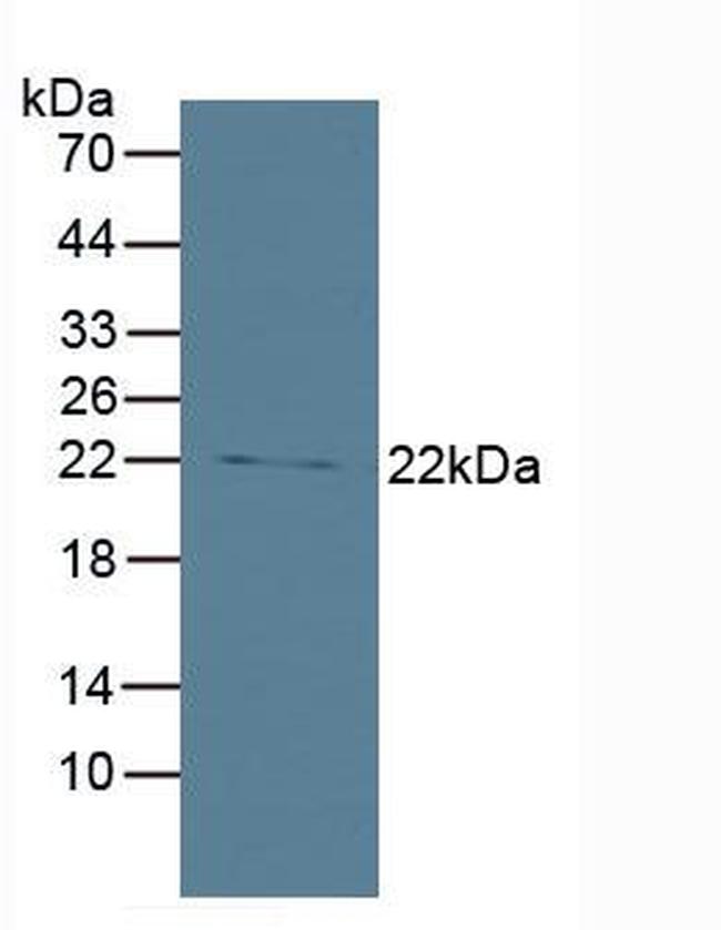 BID Antibody in Western Blot (WB)