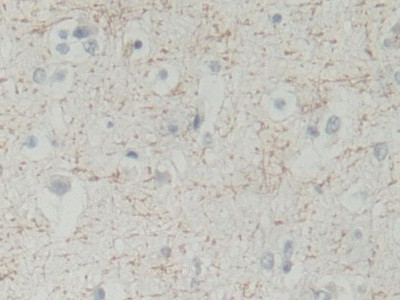 BLVRB Antibody in Immunohistochemistry (Paraffin) (IHC (P))