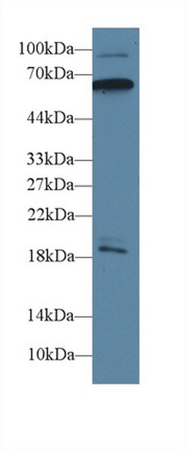 CaMKII gamma Antibody in Western Blot (WB)