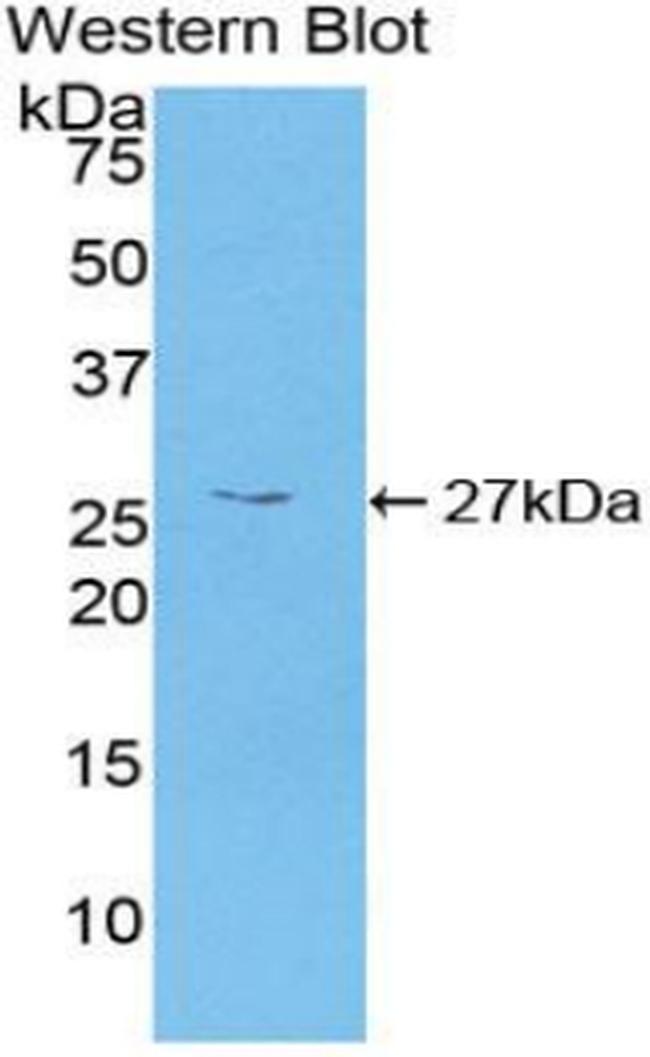 CaMKII gamma Antibody in Western Blot (WB)