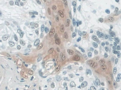 CALML5 Antibody in Immunohistochemistry (Paraffin) (IHC (P))