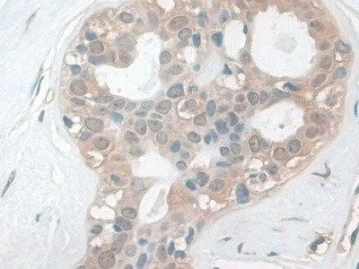 CALML5 Antibody in Immunohistochemistry (Paraffin) (IHC (P))