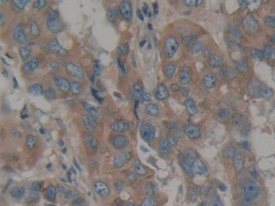 Calumenin Antibody in Immunohistochemistry (Paraffin) (IHC (P))