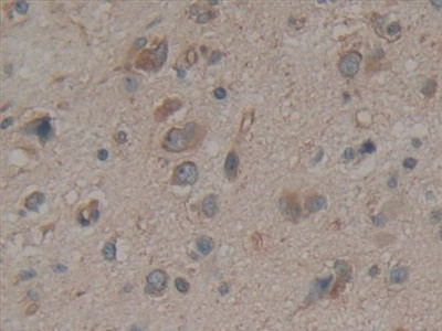 Calumenin Antibody in Immunohistochemistry (Paraffin) (IHC (P))