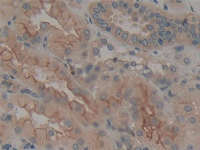 Calumenin Antibody in Immunohistochemistry (Paraffin) (IHC (P))