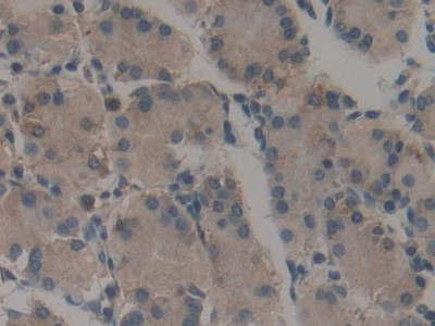 Calumenin Antibody in Immunohistochemistry (Paraffin) (IHC (P))