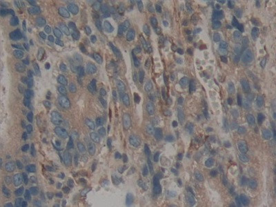 Calumenin Antibody in Immunohistochemistry (Paraffin) (IHC (P))