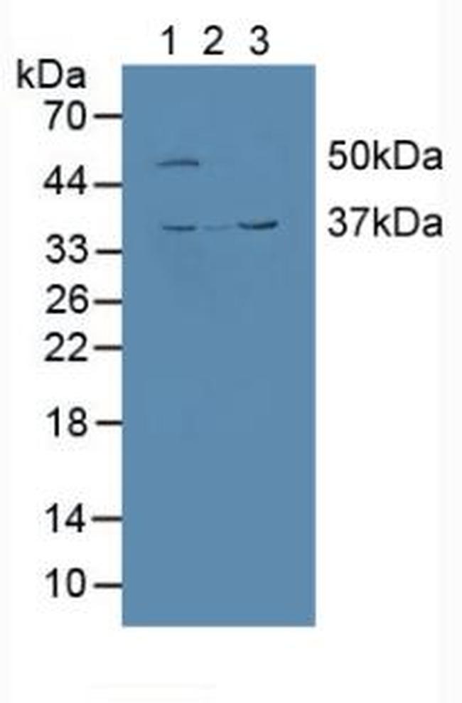 Calumenin Antibody in Western Blot (WB)