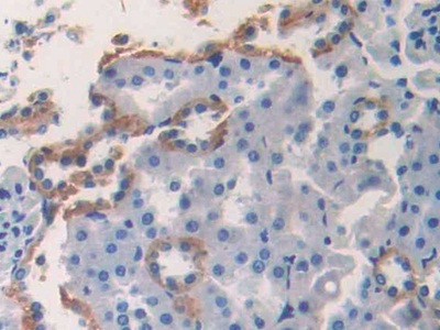 CK1 alpha Antibody in Immunohistochemistry (Paraffin) (IHC (P))