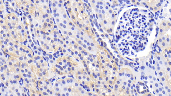 Caspase 2 Antibody in Immunohistochemistry (Paraffin) (IHC (P))