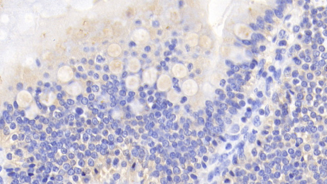 Caspase 2 Antibody in Immunohistochemistry (Paraffin) (IHC (P))