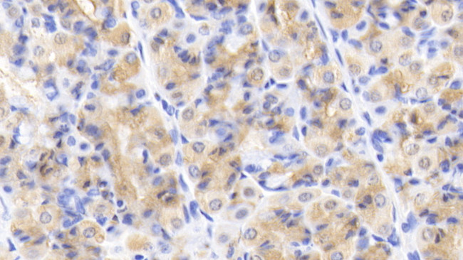 Caspase 2 Antibody in Immunohistochemistry (Paraffin) (IHC (P))