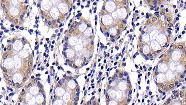 Caspase 2 Antibody in Immunohistochemistry (Paraffin) (IHC (P))