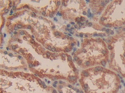 Caspase 3 Antibody in Immunohistochemistry (Paraffin) (IHC (P))