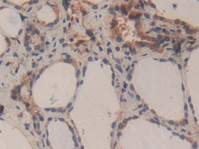 Caspase 3 Antibody in Immunohistochemistry (Paraffin) (IHC (P))