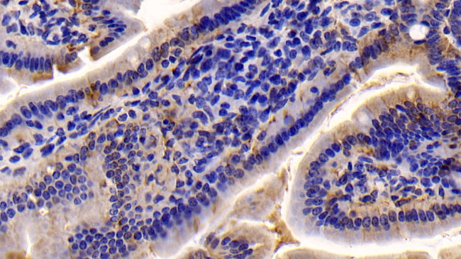 Caspase 7 Antibody in Immunohistochemistry (Paraffin) (IHC (P))