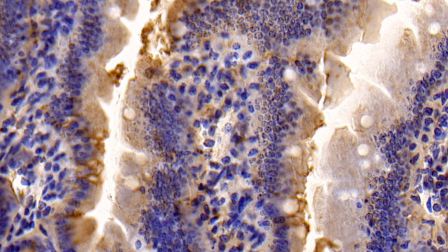 Caspase 7 Antibody in Immunohistochemistry (Paraffin) (IHC (P))