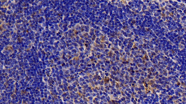 Caspase 7 Antibody in Immunohistochemistry (Paraffin) (IHC (P))