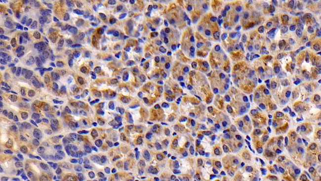 Caspase 7 Antibody in Immunohistochemistry (Paraffin) (IHC (P))