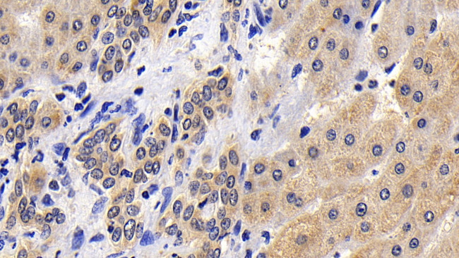 Caspase 8 Antibody in Immunohistochemistry (Paraffin) (IHC (P))