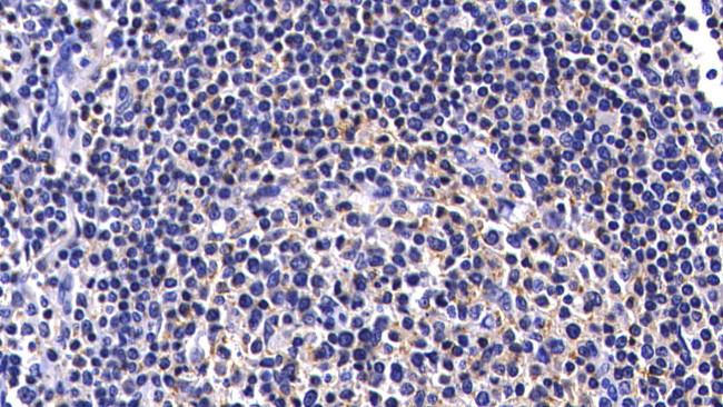 Caspase 8 Antibody in Immunohistochemistry (Paraffin) (IHC (P))