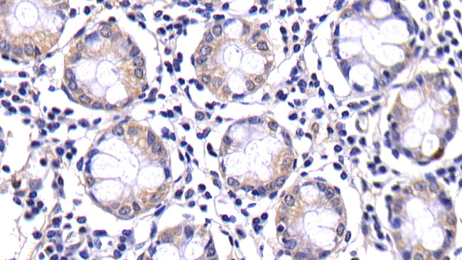 Caspase 8 Antibody in Immunohistochemistry (Paraffin) (IHC (P))