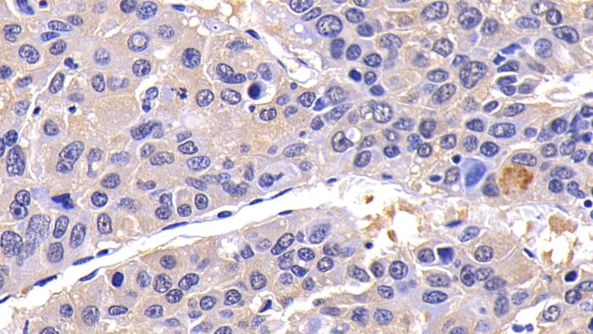 Caspase 8 Antibody in Immunohistochemistry (Paraffin) (IHC (P))