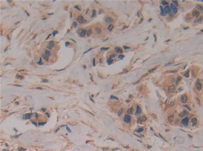 Caspase 8 Antibody in Immunohistochemistry (Paraffin) (IHC (P))