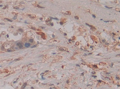 Caspase 8 Antibody in Immunohistochemistry (Paraffin) (IHC (P))