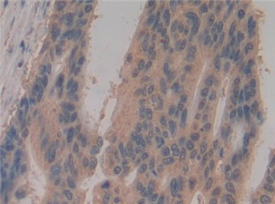 Caspase 8 Antibody in Immunohistochemistry (Paraffin) (IHC (P))