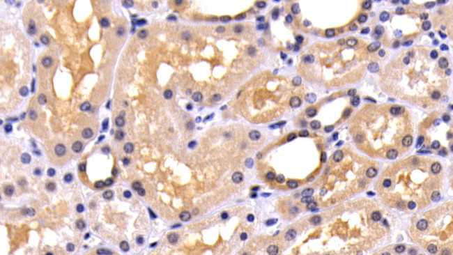 Caspase 8 Antibody in Immunohistochemistry (Paraffin) (IHC (P))