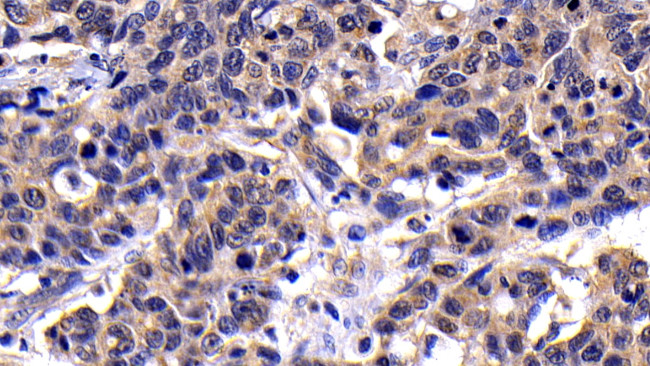 Caspase 8 Antibody in Immunohistochemistry (Paraffin) (IHC (P))