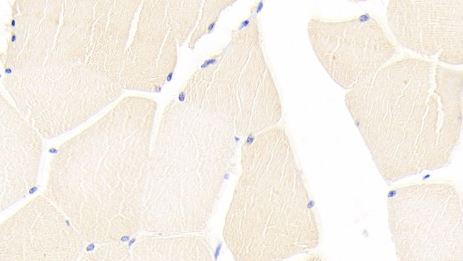 CASP9 Antibody in Immunohistochemistry (Paraffin) (IHC (P))