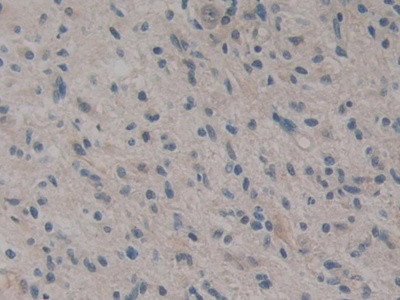 CARD9 Antibody in Immunohistochemistry (Paraffin) (IHC (P))