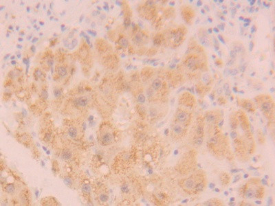 Catalase Antibody in Immunohistochemistry (Paraffin) (IHC (P))